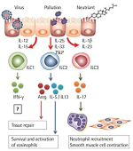 비알레르기성 호산구 천식의 발생에 있어 IL-23 역할 규명
