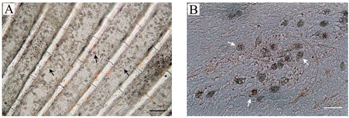 Photograph of P. dicentrarchi (arrows) infiltrated into the dorsal fin (A) and brain (B) in flounder. Scale bar : 100 ㎛.