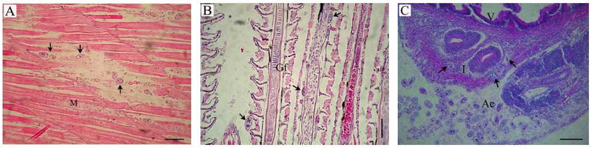 Light micrograph of the muscle (A), gill (B) and abdominal cavity (C) in the infected flounder showing P. dicentrarchi (arrows), Ac: abdominal cavity, Gf: gill filament, Iw: intestine wall, M: muscle, V: villus. HE stain. Scale bar : 50 ㎛.