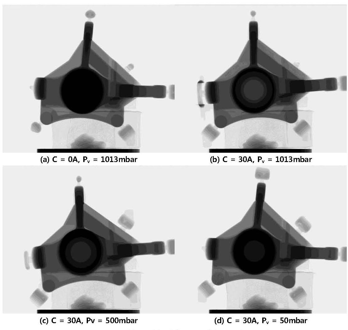 X-ray pictures of knuckle fabricated by indirect rheo-forging ; Pouring Sf=40%