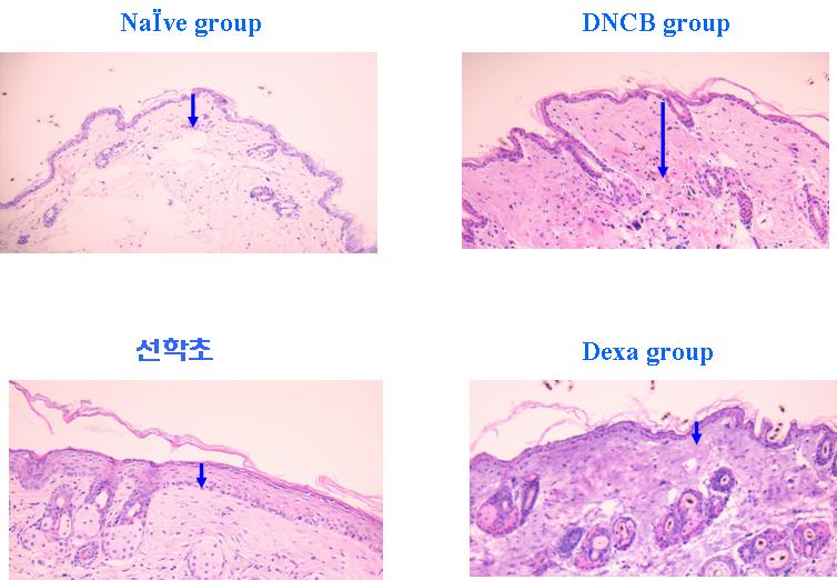 선학초를 투여한 그룹의 조직학적 세포 침윤관찰