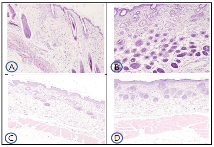 Histologic examination of dorsal skin lesion in TNCB-induced NC/Nga mice.