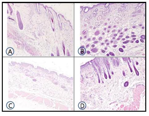 Histologic examination of dorsal skin lesion in TNCB-induced NC/Nga mice.