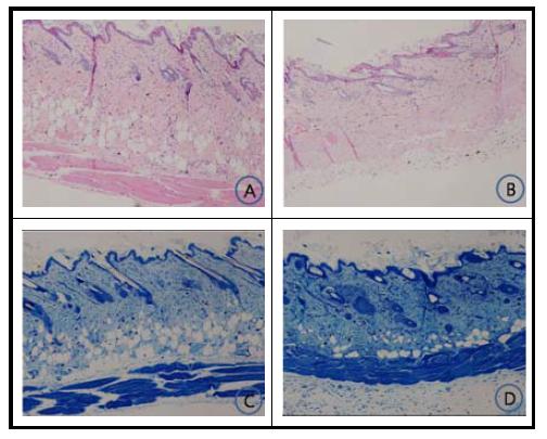 Histologic examination of dorsal skin lesion in Biostir AD-induced NC/Nga mice.