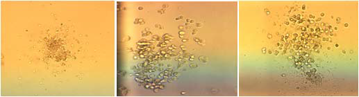 The colony formation of CFU-G, CFU-M and CFU-GM(X150)