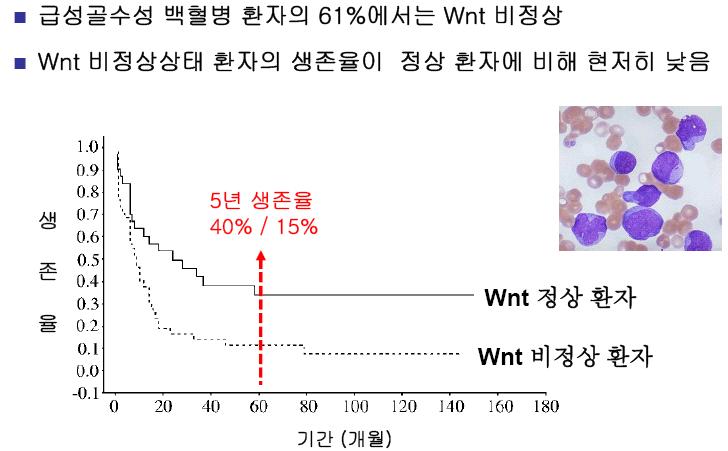 Wnt 비정상 급성골수성 백혈병 환자 (베타 카테닌 과발현)와 정상환자간의 생존율