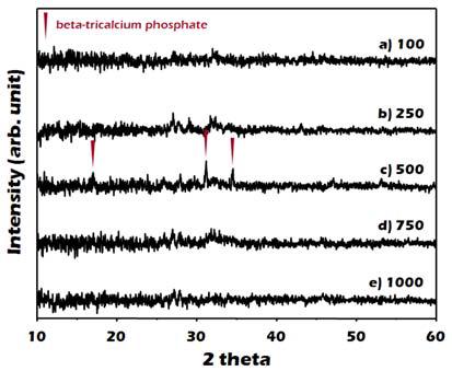 XRD patterns of synthesized calcium phosphate nanopowders depending on the radiation time : (a) 100, (b) 250, (c) 500, (d) 750 and (e) 1000 kGy [7.64 mA].