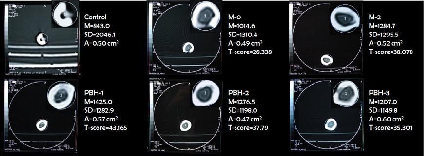 Images of computed tomography.