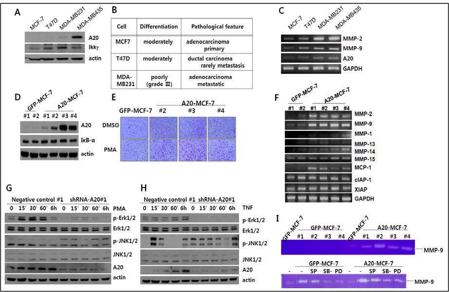 유방암 암화과정 및 전이능에서 과발현된 A20의 기능 (A, B, C) 여러 유방암 세포주에 서 A20 및 MMP-2/9의 발현 분석. (D, E) MCF-7 세포에 A20 과발현 세포주 구축 및 이를 이 용한 PMA-의존적 전이능 항진 (F) A20-과발현 세포주에서 invasiveness 관련 유전자 발현 비교 (G, H) MDA-MB231세포주에 ShRNA에 의한 A20 발현의 knock down 세포주를 구축한 후 PMA 및 TNF에 의한 MAPK 활성도 분석. (I) A20-과발현 세포주에서의 PMA에 의해 유도된 MMP-9의 활성도 비교 및 MAPK 억제제의 영향 분석.