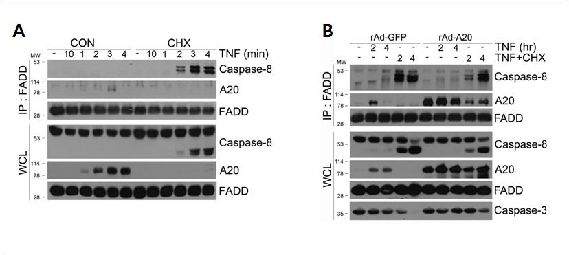 TNF 수용체 signaling complex Ⅱ에 recruit되는 A20 및 A20 과발현에 의한 signaling complex의 변화