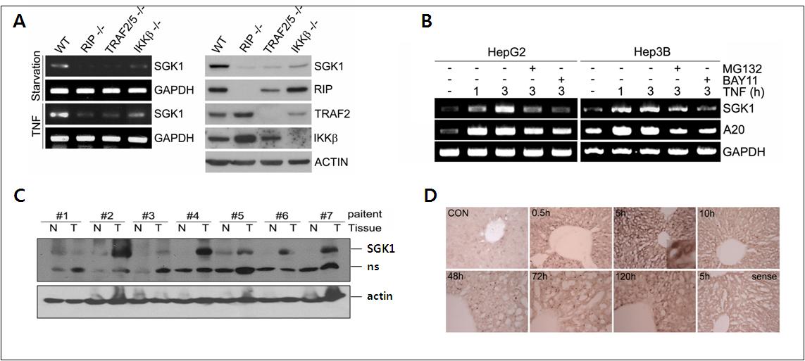NF-kB-의존적 SGK1의 발현 및 간암/재생간에서의 과발현 현상