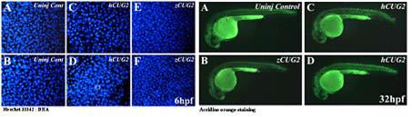 hCUG2 overexpression induces apoptotic cell death in Zebra fish