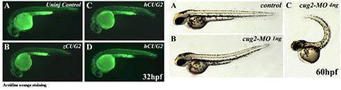 Inhibition of CUG2 induces severe apoptotic cell death and deformation in Zebra fish