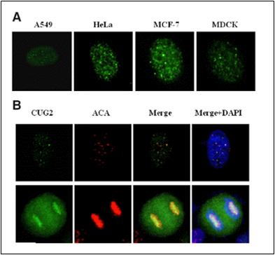 Centromeric localization of CUG2 in various stable cells (A) Distribution of flag-CUG2 in various stable cells. A549, HeLa, NCF-7, and MDCK cells expressing flag-CUG2 were immunostained with and-flag antibody. (B) Flag-CUG2 A549 stable cells were incubated with anti-flag antibody in combination with ACA antiserum as a probe for centromere marker.