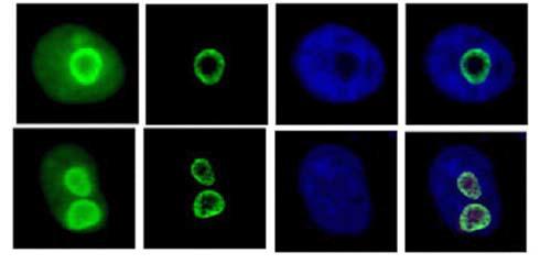 CUG2 is enriched in nucleolar heterochromatin region