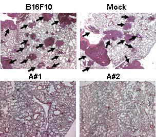Ard1이 과발현 하는 B16F10 세포주를 C57BL/6 mice의 미정맥에 주입 2주후 마우스의 폐 조직을 H A#2, B16F10-Ard1 #2.