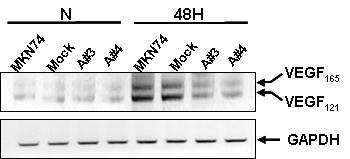 1 % O2 (48H) 또는 21 % O2 (N, 48h) 처리한 MKN74 세포에서 RT PCR를 이용하여 VEGF 발현 측정. A#3, MKN74-Ard1 #3; A#4, MKN74-Ard1 #4.