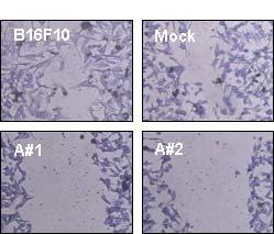 Ard1이 과발현 하는 B16F10 세포주의 migration. A#1, B16F10-Ard1 #1; A#2, B16F10-Ard1 #2.