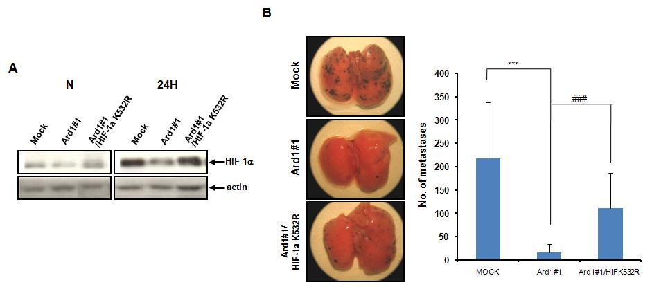 A) Ard1225가 과발현 하는 B16F10 암세포주에 lysine 532 잔기가 돌연변이 된 HIF-1α 가 과발현하는 B16F10 세포주에서 HIF-1α발현 확인. B) Ard1225_HIF-1α_K532R가 과발현 하는 B16F10 세포주를 미정맥 투여 2주후 대표적인 폐 사진(오른쪽). 페에 생긴 암 노즐 수 측정(왼쪽).
