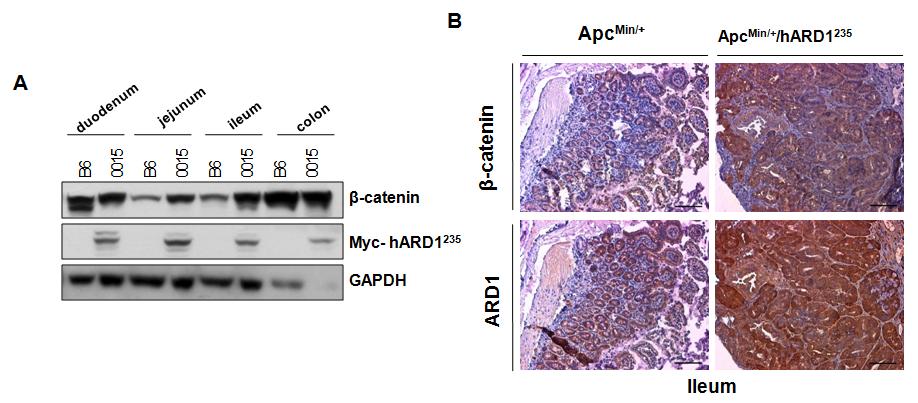 A) Ard1235 유전자 과발현 마우스의 장과 wild 마우스 장에서western blot을 이용하여 β-catenin 발현 비교. B) ApcMin/+ 마우스와 ApcMin/+/ARD1235 의 장에서 β-catenin 면역염색