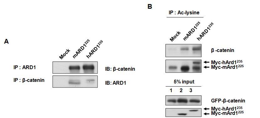 A) 293T cell에 Ard1225, Ard1235와 β-catenin immunoprecipition. B) Ard1225, Ard1235에 의한 β-catenin 아세틸화
