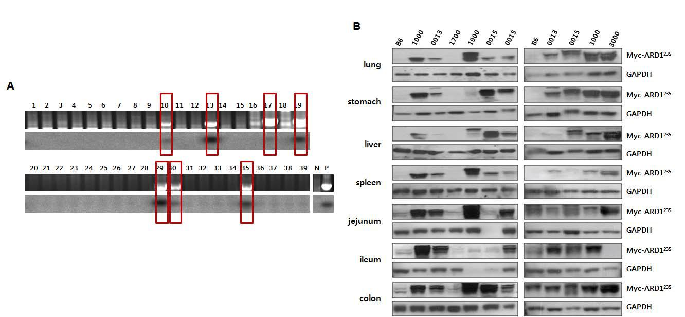 A) 수정란에 injectional DNA 미세주입 후 산자의 genomic DNA에서 southern bolt과 PCR 기법에 의해 Ard1235 발현 확인. B) Ard1235 과발현 마우스의 각 장기로부터 western bolt 기법을 통해 Ard1235 단백질의 발현 확인.