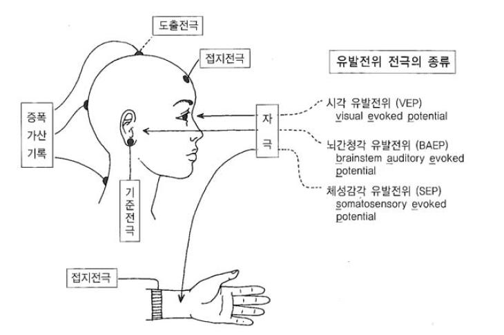 유발전위의 종류와 기록법