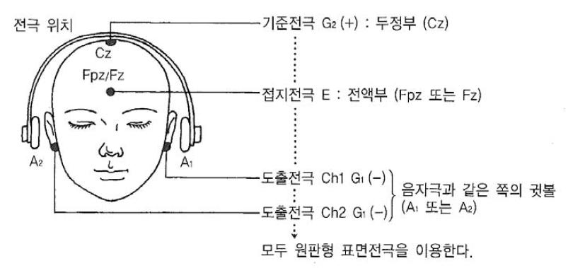 청각유발전위(AEP)의 측정법