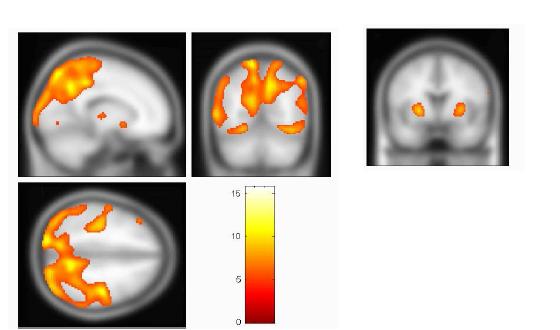 greater activation for older participants