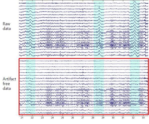 Raw EEG sequence and artifact free EEG using ICA.