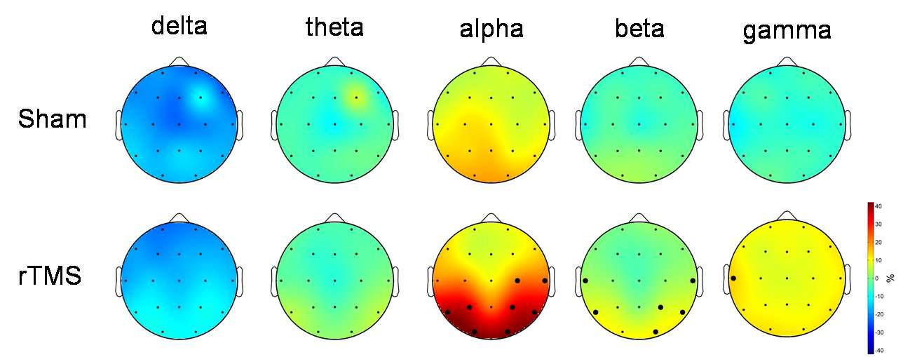 Amplitude change ratio, Rj, for each frequency components and stimulus conditions (Sham: upper panel, rTMS: lower panel). Small black dots mean channel location and big black dots denote significantly different area.