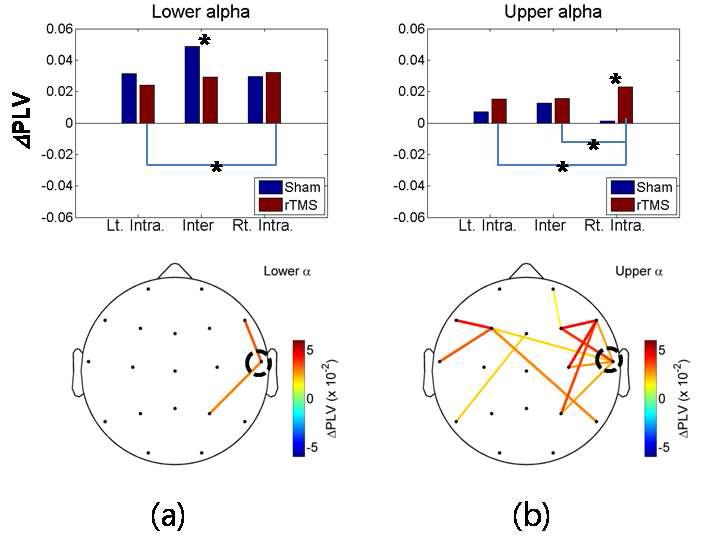 Left/right intra- and inter-hemispheric PLV changes of lower-alpha (a) and upper-alpha (b). In the bottom, significant increased PLV pairs were presented. Dashed black circle mean the position of rTMS. The upper panel notation is same as Figure 4.bottom panel.