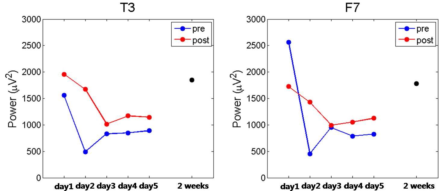 Mean power changes for each days. Epiletiform discharges, spikes and sharp waves, were dominant in T3 and F7. This result was obtained from a patient who has been suffering from left frontal lobe epilepsy.