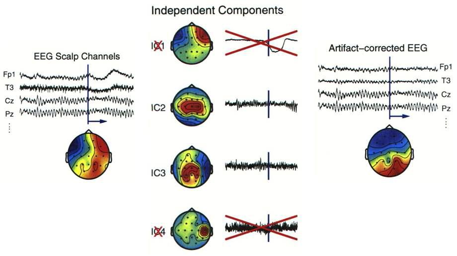 Schematic diagram for artifact removing with ICA.