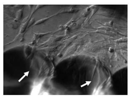 다공성 하이드로젤 표면에 부착된 fibroblasts.