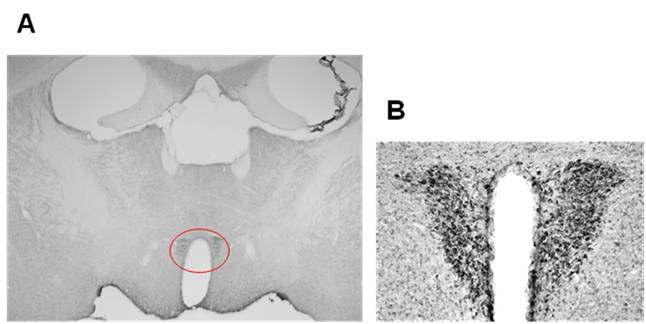 마우스 뇌 PVN 부위에서의 immunohistochemical staining(DAB) 결과.