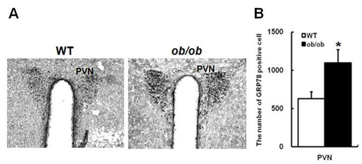 ob/ob와 WT 마우스 PVN에서의 GRP78에 대한 immunohistochemical staining(DAB) 결과.