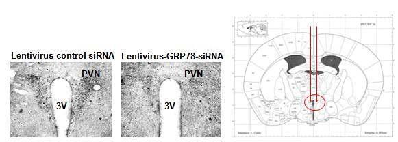 Lentivirus-mediated GRP78 knockdown in PVN. DAB-staining image of coronal brain section in PVN