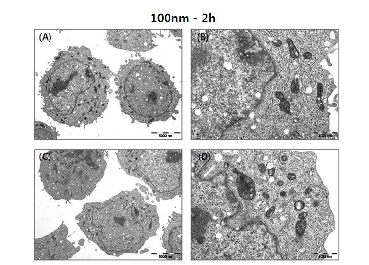 Confirm the autophagy and mitochondria damage (100nm, 2hr).