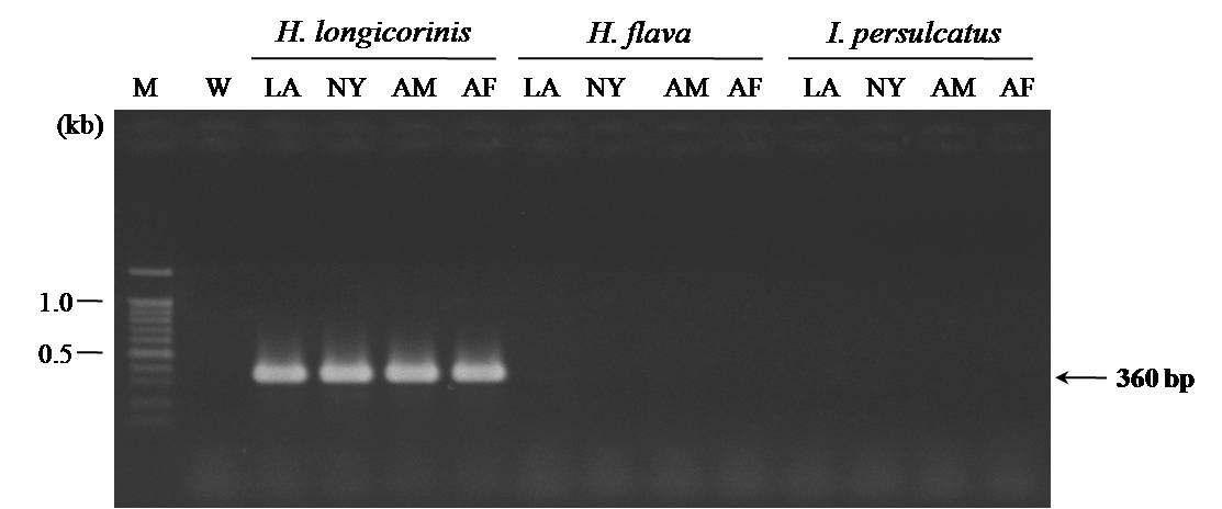 Agarose gel electrophoresis of H. longicornis tick 5.8S rRNA internal transcribed spacer 2 gene (360 bp amplicons). Lane M, 100 base pair size marker. Abbreviation of each lane is as follows: W, water control; LA, larva; NY, nymph; AM, adult male; AF, adult female.