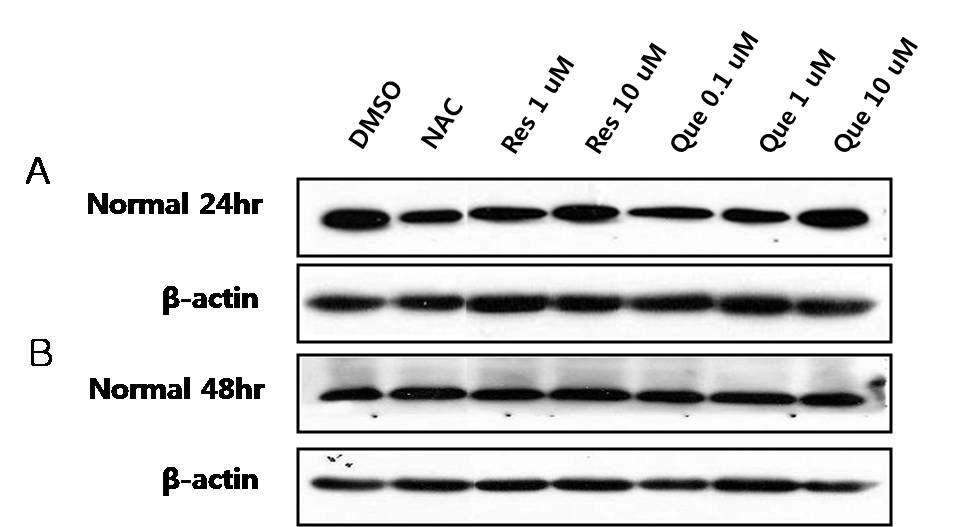 Western blot 분석을 통한 정상인 (Normal)의 lymphoblast cytochrome C 양적 수준 확인.