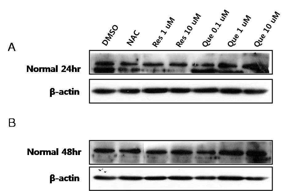 Western blot 분석을 통한 정상인 (Normal)의 lymphoblast에서 ER stress sensor 역할을 수행하는 ATF6α 단백질의 발현수준 확인.