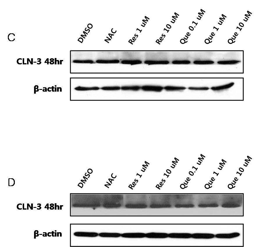 Western blot 분석을 통한 바텐병 환자 (Batten disease patient)의 lymphoblast에서 ER stress sensor 역할을 수행하는 ATF6α 단백질의 발현수준 확인.