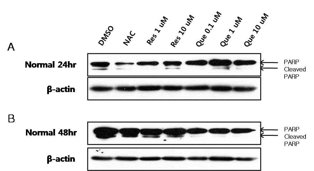 정상인 (Normal)의 lymphoblast 세포에 Caspase cascade 단계 후 세포사멸의 특징적 징후인 PARP cleaved 의 양적 수준 확인.