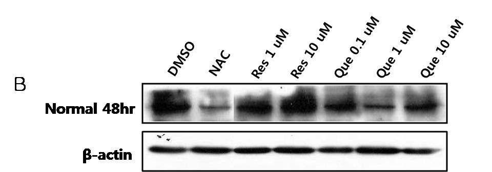 정상인 (Normal)의 lymphoblast 세포에서 (48hr) ROS에 대항하는 중요한 내인성 항산화효소인 catalase의 발현수준 및 항산화 효과 확인.