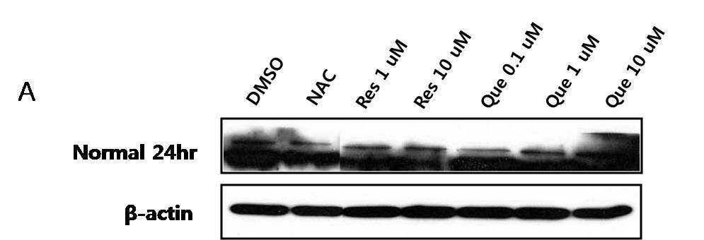 정상인 (Normal)의 lymphoblast 세포에 (24hr) ER stress의 marker 및 unfolded 단백질에서 folded 단백질로의 전환을 일으키는 Grp-78/Bip 단백질의 발현수준 확인.