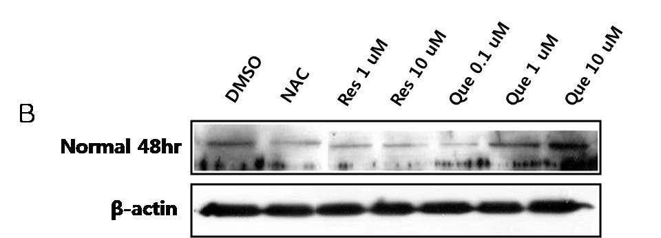 정상인 (Normal)의 lymphoblast 세포에 (48hr) ER stress의 marker 및 unfolded 단백질에서 folded 단백질로의 전환을 일으키는 Grp-78/Bip 단백질의 발현수준 확인.