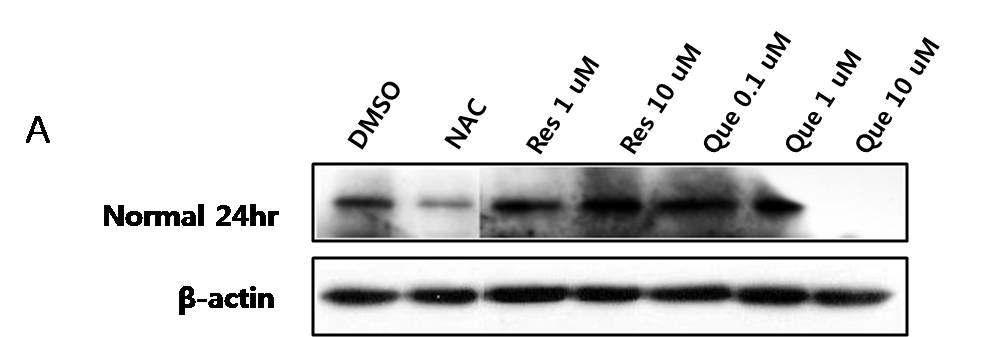 정상인 (Normal)의 lymphoblast 세포에 (24hr) 세포 주기를 조절하는 p21의 발현수준 확인.