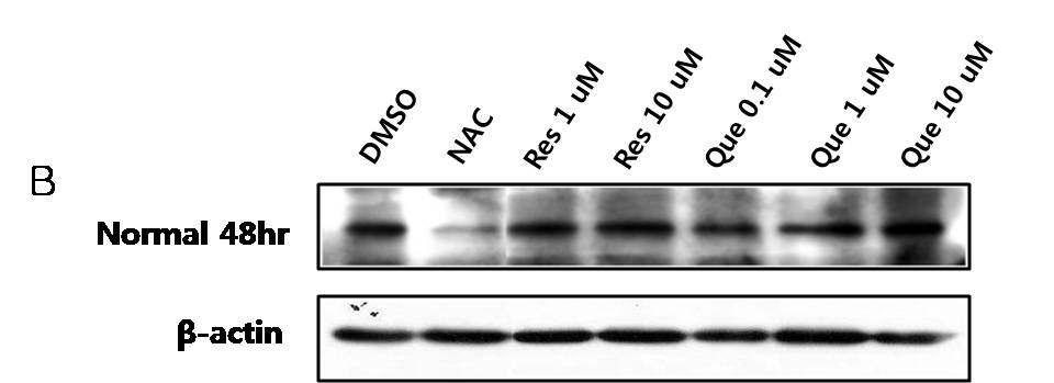 정상인 (Normal)의 lymphoblast 세포에 (48hr) 세포 주기를 조절하는 p21의 발현수준 확인.