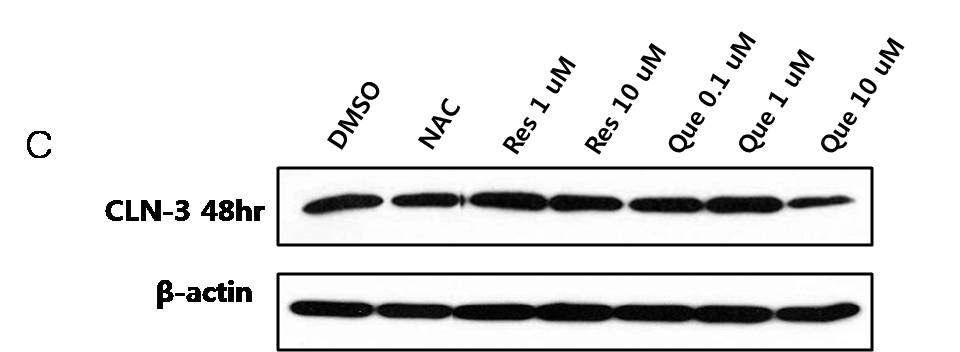 바텐병 환자 (Batten disease patient)의 lymphoblast 세포에 (48hr) 세포 주기를 조절하는 p21 의 발현수준 확인.